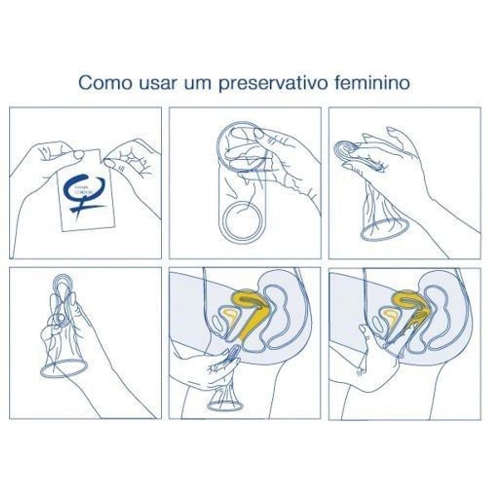 Della Preservativo Feminino